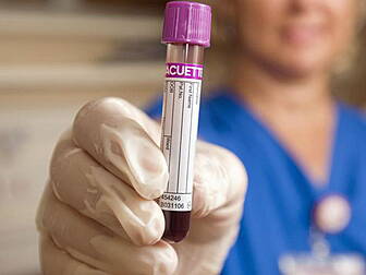 Irish cancer survival rates am...
